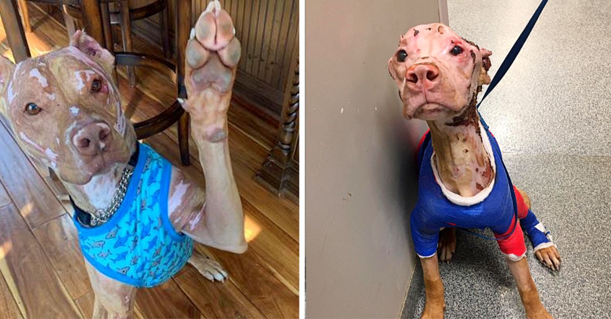 This Pitbull once severely burned, defies odds, now embraces life